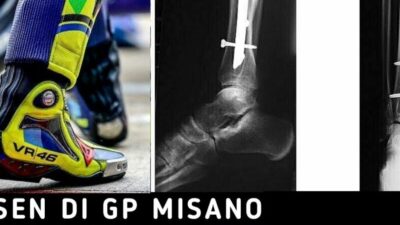 Data & Fakta MotoGP Misano San Marino 2017 “Tanpa Rossi”