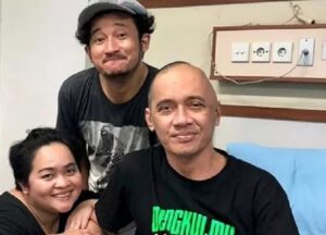 Mengenal Glioblastoma, Kanker Otak Yang Gerogoti Agung Hercules