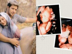 5 Fakta Kondisi Irish Bella Sebelum Bayi Kembarnya Meninggal
