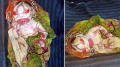 Ibu Ini Tolak Peluk dan Susui Bayinya Yang Mirip Alien