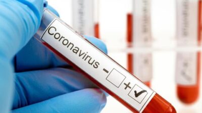 Melonjak Lagi! 8.369 Kasus COVID-19 di Indonesia, Papua dan Jabar Tertinggi