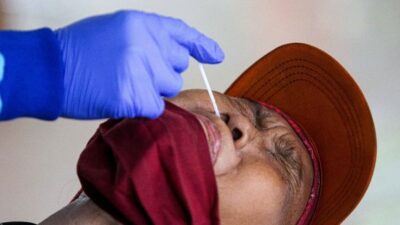 Biaya Tes PCR Pernah Tembus Jutaan Rupiah, Ternyata Harga Reagennya Hanya Rp.13 Ribu