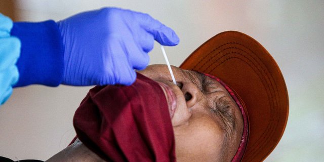 Biaya Tes PCR Pernah Tembus Jutaan Rupiah, Ternyata Harga Reagennya Hanya Rp.13 Ribu