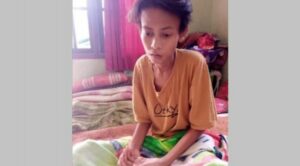 Usai Divaksin COVID-19, Pelajar di Pandeglang Alami Demam Tinggi Berkepanjangan, Tubuh Kurus Kering
