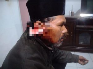 Muadzin di Sukabumi Dibacok Telinganya Oleh Pria Misterius Saat Sholat Shubuh