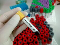 Mematikan! Virus Hendra Menular Dari Kelelawar ke Kuda Lalu ke Manusia
