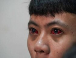 Temuan TGIPF: Korban Tragedi Kanjuruhan Alami Pendarahan Mata hingga Trauma