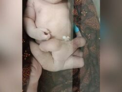 Geger! Bayi di Lombok Lahir Dengan 6 Kaki, Kembarannya Lahir Tanpa Kepala