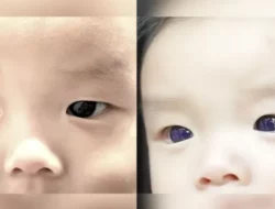 Mata Bayi Ini Berubah Jadi Biru Usai Diberi Obat Antivirus COVID-19