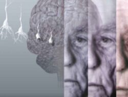 Ilmuwan Gunakan AI Untuk Prediksi Alzheimer Tujuh Tahun Sebelum Gejala Muncul