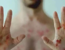 Waspada! Ketahui Sumber Penularan Mpox Yang Kini Sudah Menyebar di Indonesia
