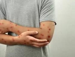 Antisipasi Mpox, Pendatang Dari Luar Negeri Wajib Isi SATUSEHAT Health Pass