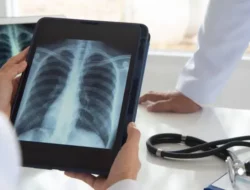 4 Target Penuntasan TB, Indonesia Masih Jadi Peringkat Dua Dunia
