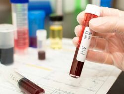 Masih Ada 356 Ribu ODHIV, Kemenkes Tetap Pede Indonesia Bebas AIDS dan IMS 2030
