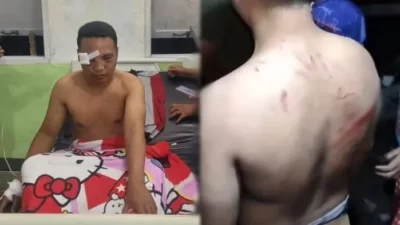 Guru SMK Talaud Babak Belur Dianiaya Anggota TNI AL Diduga Mabuk di Pelabuhan Melonguane