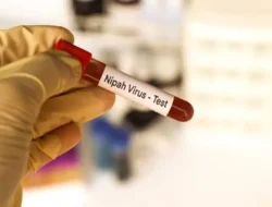 Tingkat Kematian Sangat Tinggi, Indonesia Diminta Hati-hati Penularan Virus Nipah